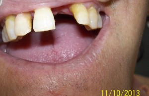 Consultorio Medico Odontologico Dra Odontologa Silvina Crisi Implantes dentales